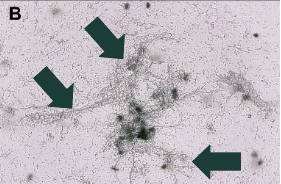 Micrograph of pelleted equicenta&reg; CTM stained with hematoxylin showing filamentous-form matrix, marked with green arrows