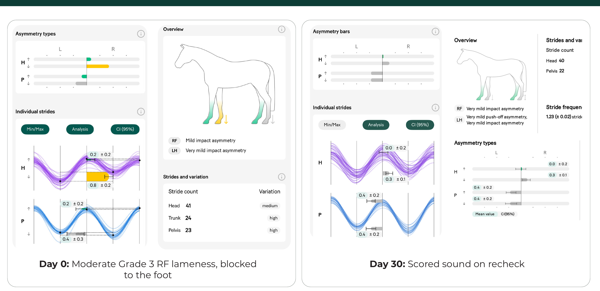 Day 0 vs Day 30 gait analysis comparison
