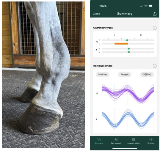 Day 30 — leg comparison and gait analysis showing measurable improvement