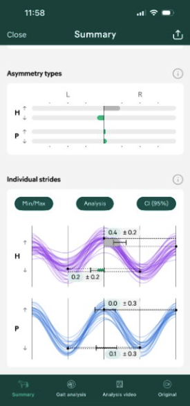 Day 90 gait analysis — symmetry restored, cleared for return to work