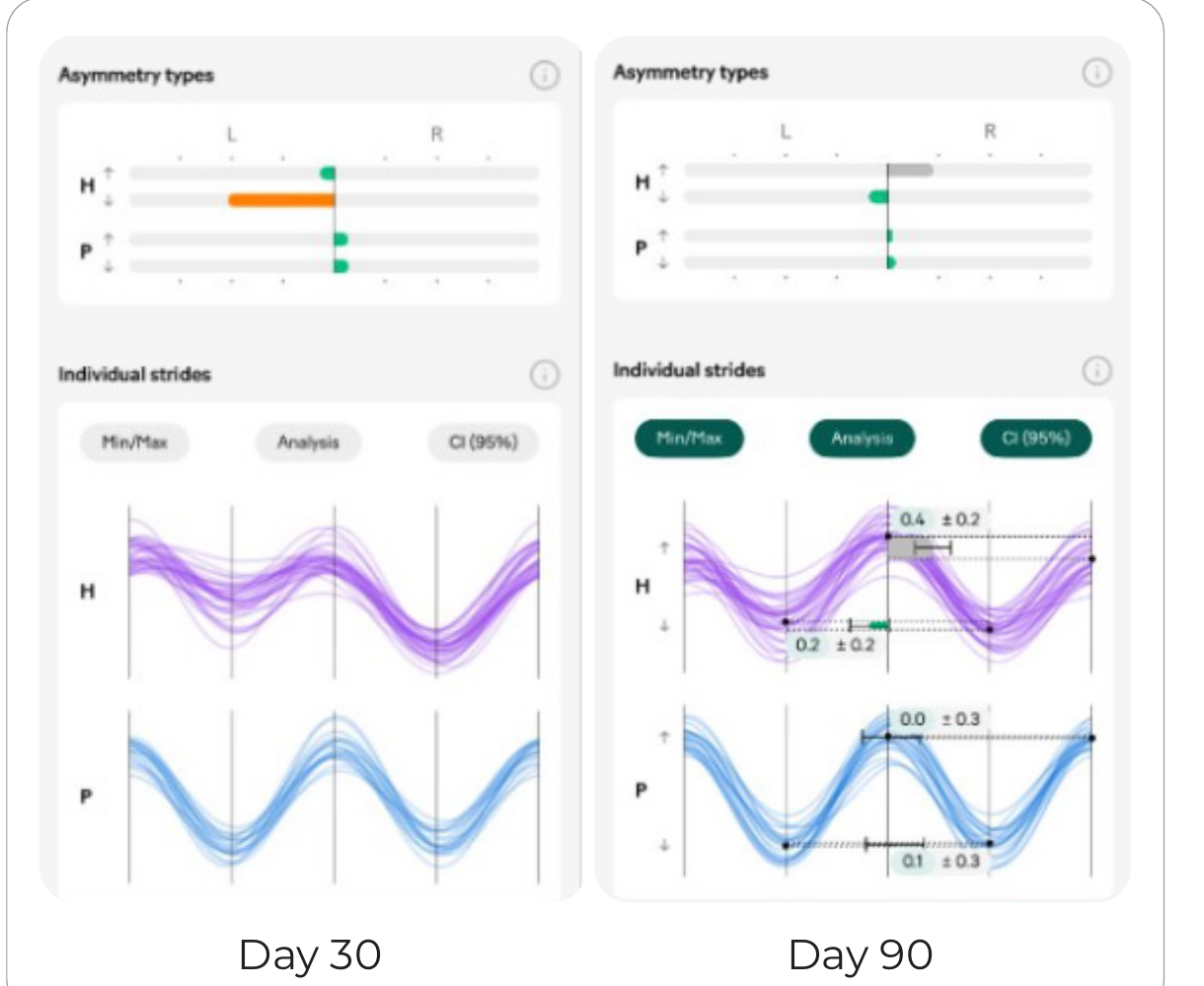 Day 30 vs Day 90 gait analysis comparison