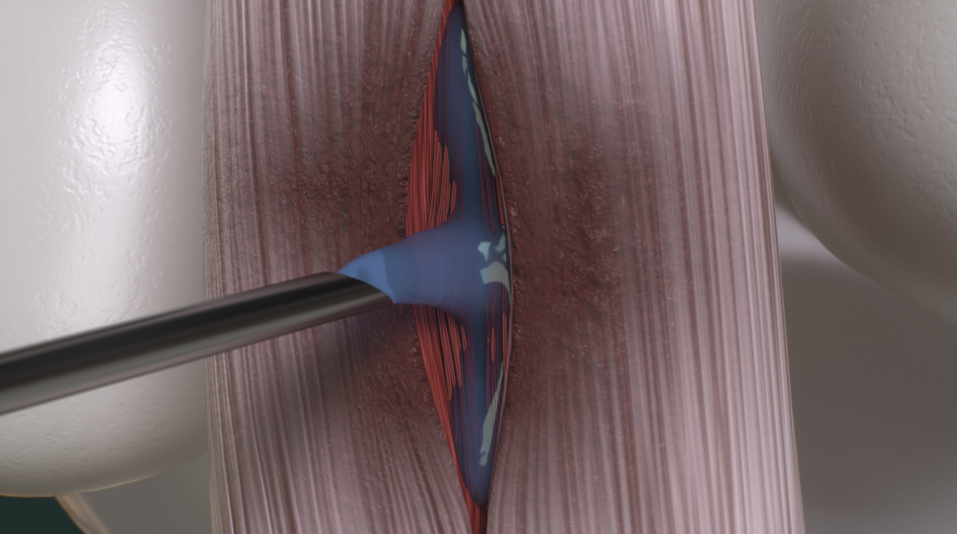 Case 2: musculoskeletal tissue injury anatomy